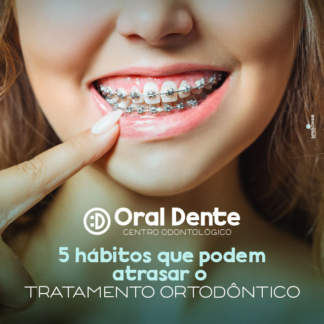 5 hábitos que podem atrasar o tratamento ortodôntico – Oral Dente